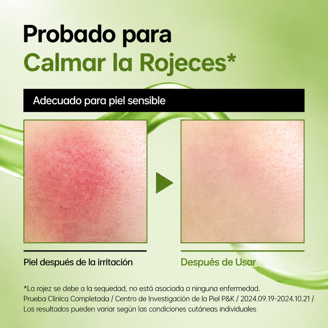 ANUA CALMA™  Sérum Calmante de Ácido Azelaico 10% + Hialurónico